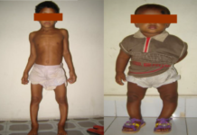 National Rickets Survey in Bangladesh, 2008