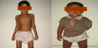 National Rickets Survey in Bangladesh, 2008