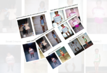 Childhood Rickets in Bangladesh: Newly emerged public health challenge from the first national survey