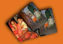 SURVEY: Rickets identification in Cox’s Bazaar